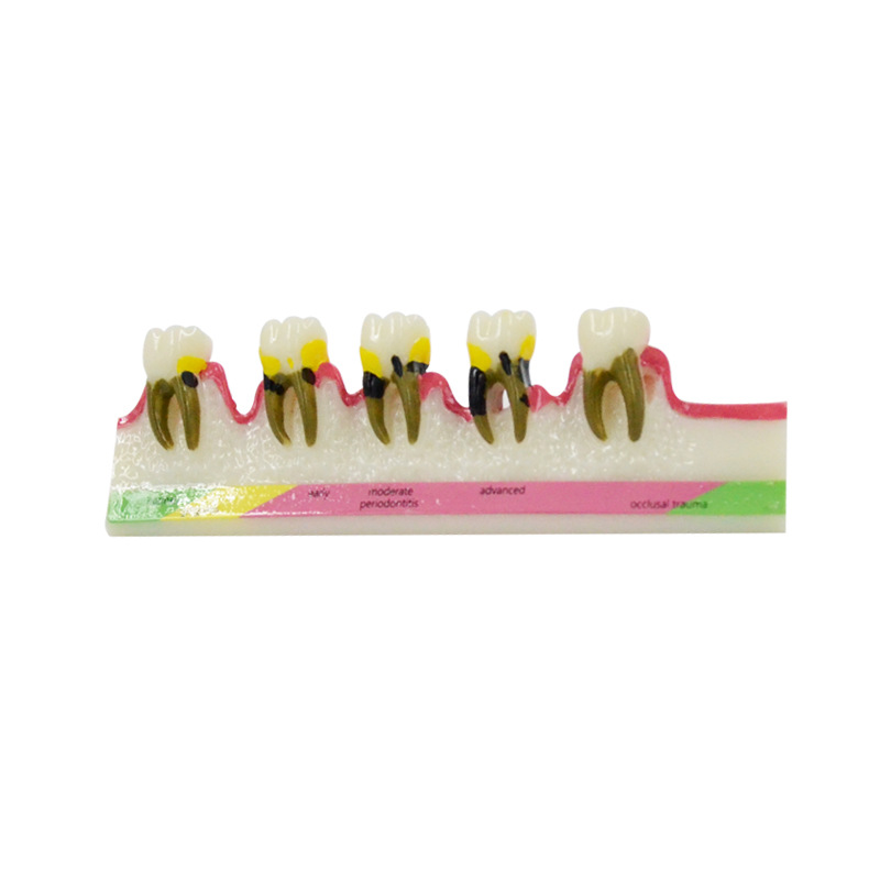 Medical Lab Study - Periodontal Disease Model Dental Materials Lab
