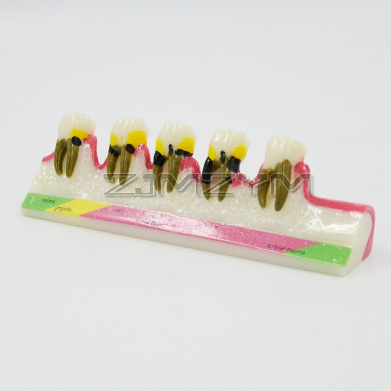Periodontal Disease Model Dent - Medical Lab Study 评论和价格