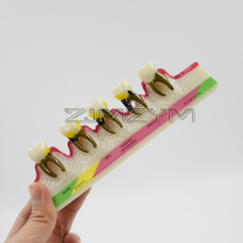 Periodontal Disease Model Dent - Medical Lab Study 评论和价格